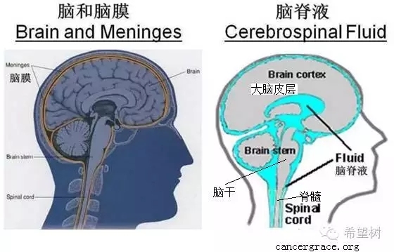非小细胞肺癌脑膜转移