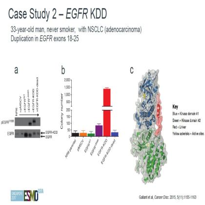 Genomic profiling of 114,200 advanced cancers identifies recurrent kinase domain duplications (KDD)