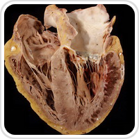 Webpathology.com-镜像翻译（自学使用，版权归原网站所有）
