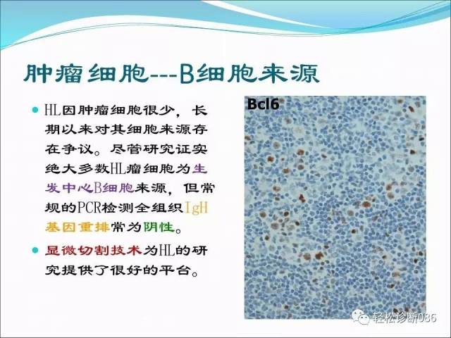 霍奇金淋巴瘤