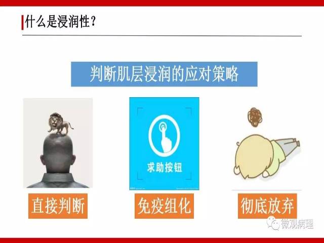 泌尿课程/浸润性尿路上皮癌病理学类型