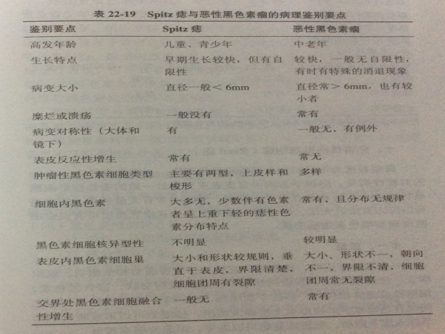 伴上皮样细胞的肿瘤一一一Spitz痣和恶性黑色素瘤