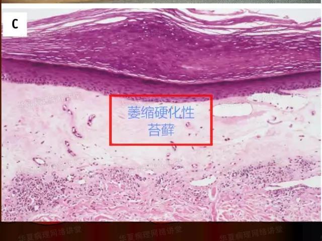 学习《病理诊断的关键点》：病理诊断中的“充分与必要”条件