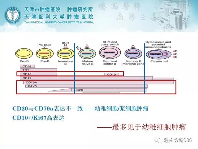 淋巴母细胞淋巴瘤