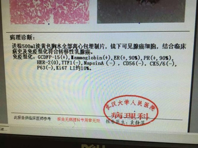 病理科新技术(一)：细胞蜡块
