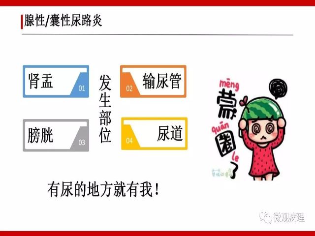 泌尿课程/尿路腺样病变的诊断要点