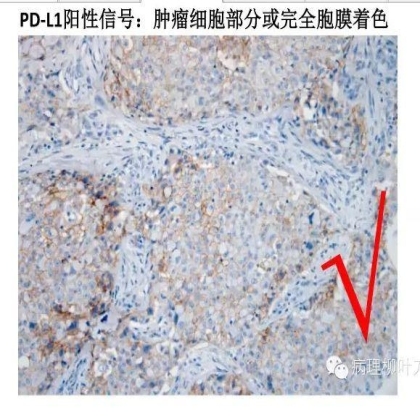 肿瘤精确医疗与分子病理检测