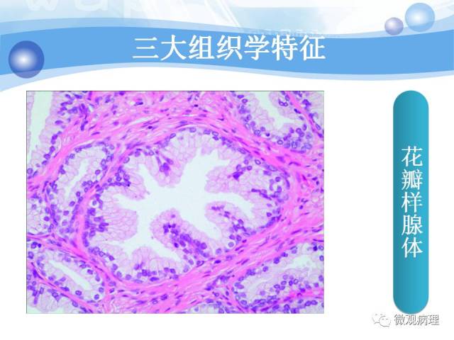 正常前列腺组织学
