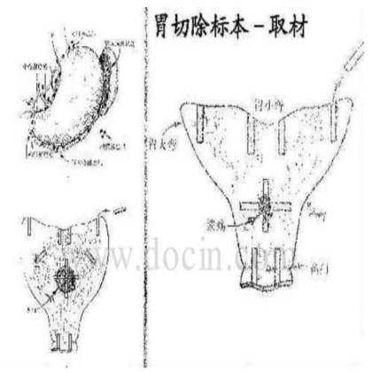 病理标本取材规范