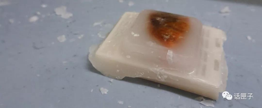 肿瘤还是囊肿?恶性还是良性?他们说了算!这群“幕后高手”,你未必了解…… 肿瘤还是囊肿?恶性还是良性?他们说了算!这群“幕后高手”,你未必了解……