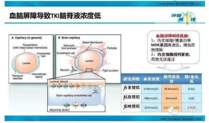 驱动基因阳性NSCLC脑转移：阿克琉斯之踵？