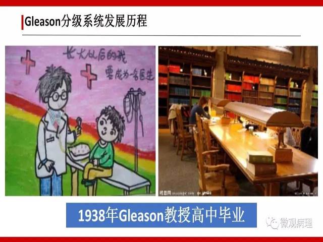 前列腺癌Gleason分级系统的前世今生