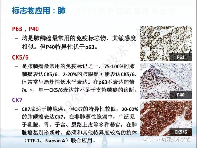 免疫组化检测的临床应用与质量评估