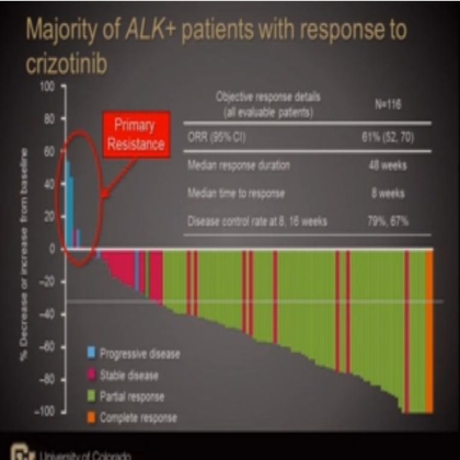 Analysis of resistance mechanisms to ALK kinase inhibitors in ALK+ NSCLC patients