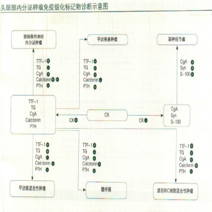 头颈部内分泌肿瘤免疫组化标记物诊断示意图