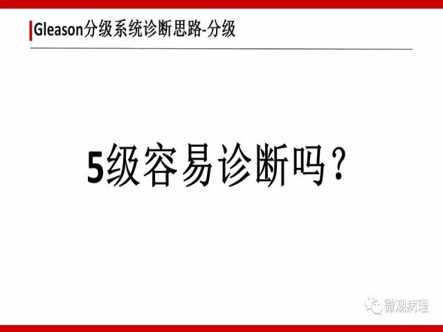 前列腺癌Gleason分级系统的前世今生