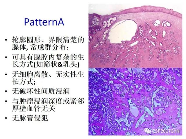 病理临床结合 开拓诊断视野