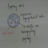Breast Papillary Les