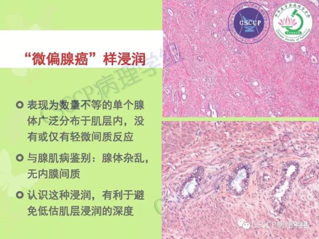 宫颈与子宫病变病理标本取材