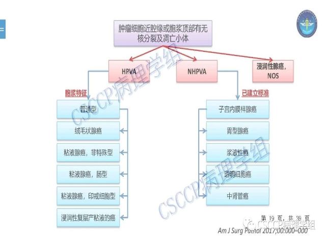 黄文亭 张询：宫颈腺癌分类介绍