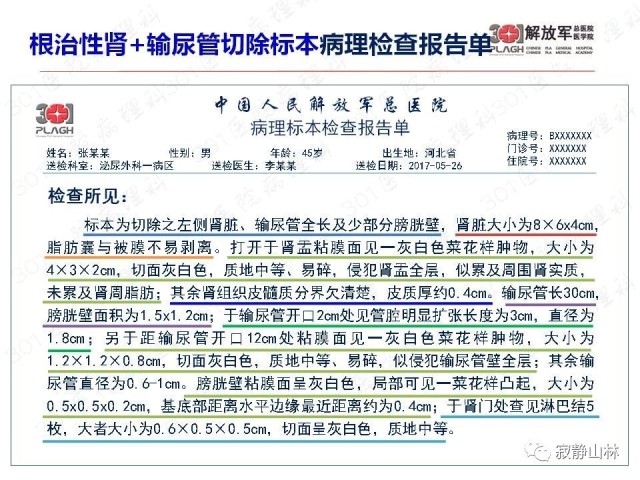 泌尿系统常见肿瘤标本病理报告规范