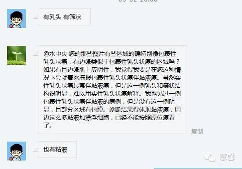 伴有筛状及乳头状结构的浸润性导管癌（水中央分享，吴焕文及孔祥田老师讲解）
