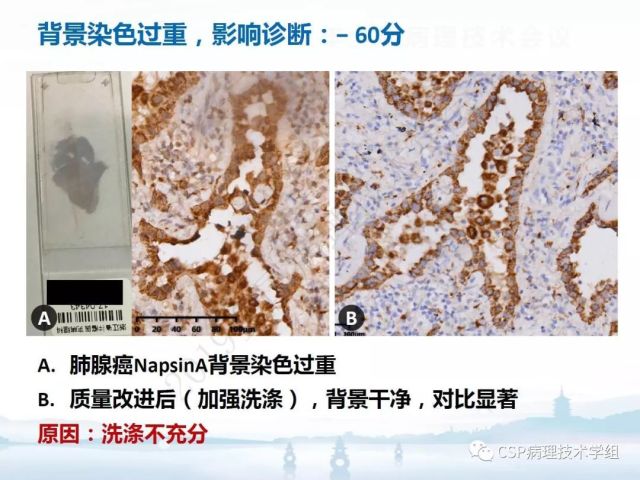 免疫组化检测的临床应用与质量评估