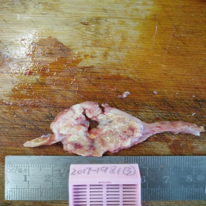 病理科工作札记（十七）胃间质瘤