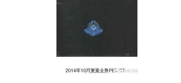中日韩个体化诊疗案例大赛经典赏析之十——EGFR敏感突变患者，如果TKI原发性耐药，需警惕合并其他驱动基因变异！