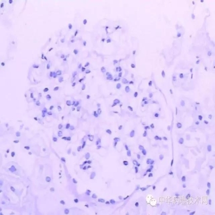 肾穿活检组织特殊染色方法