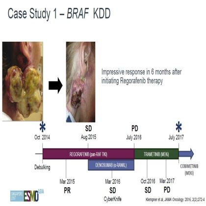 Genomic profiling of 114,200 advanced cancers identifies recurrent kinase domain duplications (KDD)