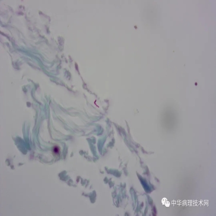如何避免抗酸染色假阳性