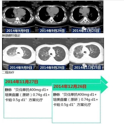 中日韩个体化诊疗案例大赛经典赏析之十——驱动基因双突变，两种靶向药物均无效，个体化治疗的阿克琉斯之踵