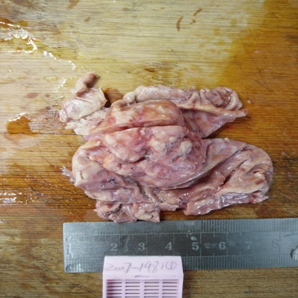病理科工作札记（十七）胃间质瘤