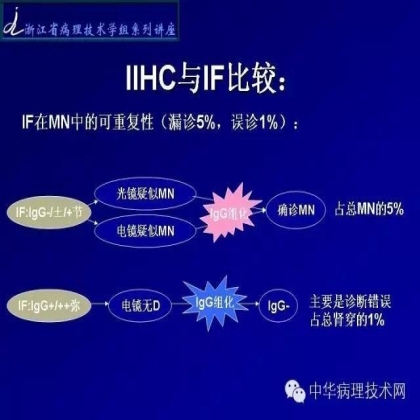 探讨免疫组织学在肾穿标本中的应用