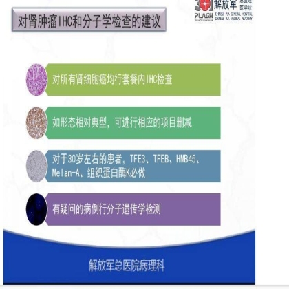 肾上皮性肿瘤免疫组化诊断基本流程
