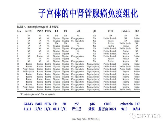 妇科肿瘤病理新进展——特殊类型的腺癌
