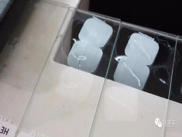 肿瘤还是囊肿?恶性还是良性?他们说了算!这群“幕后高手”,你未必了解…… 肿瘤还是囊肿?恶性还是良性?他们说了算!这群“幕后高手”,你未必了解……
