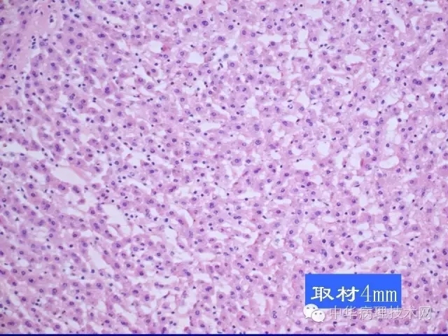 影响冰冻切片质量的原因（比赛注意事项）