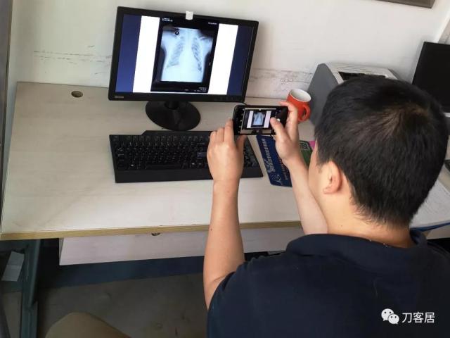 医生及患者通用:如何用手机翻拍X线片,磁共振片子,CT片子进行网络求医、病例讨论及保留资料 医生及患者通用:如何用手机翻拍X线片,磁共振片子,CT片子进行网络求医、病例讨论及保留资料