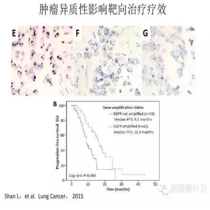 肿瘤精确医疗与分子病理检测