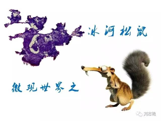 另类甲状腺FNA细胞学