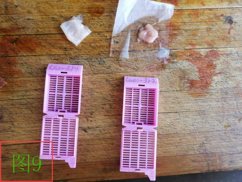 细胞蜡块的制作及应用举隅