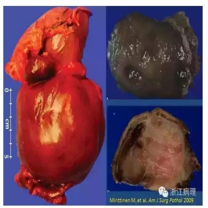 病理标本送检制度