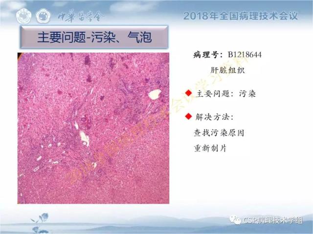 宋欣：HE切片质量控制及常见问题分析