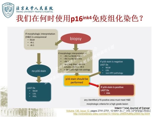 中华病理学会基层培训遵义站讲座（三）——宫颈鳞状上皮病变的病理诊断与鉴别诊断