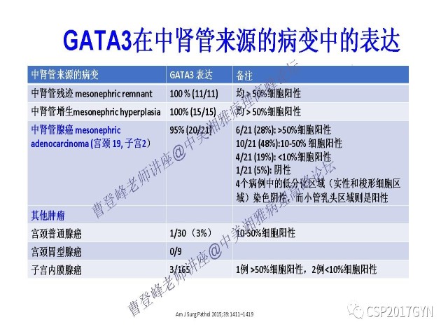 妇科肿瘤病理新进展——特殊类型的腺癌