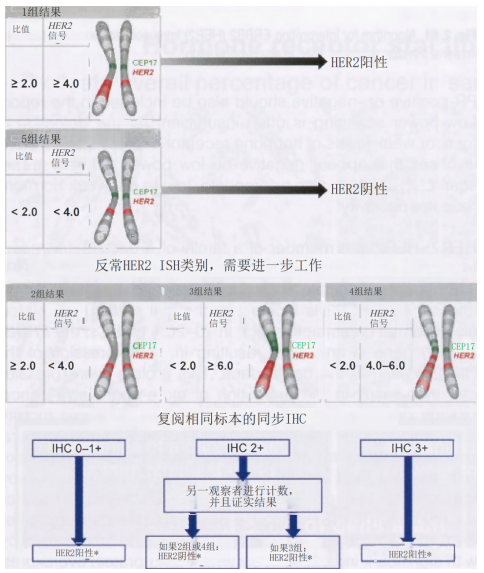 乳腺肿瘤WHO分类学习笔记（连载9）