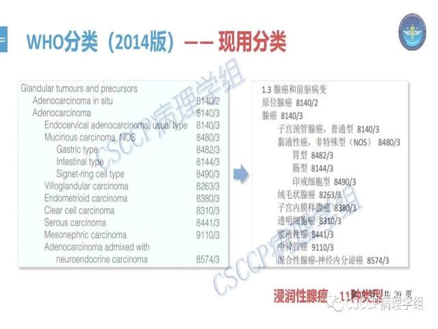 黄文亭 张询：宫颈腺癌分类介绍