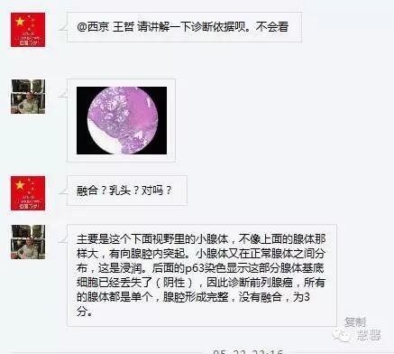 前列腺腺癌？（芳分享病例，华夏泌尿群讨论，孔祥田老师讲解）